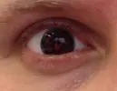 STEPHENS HORDE EYE cropped.webp